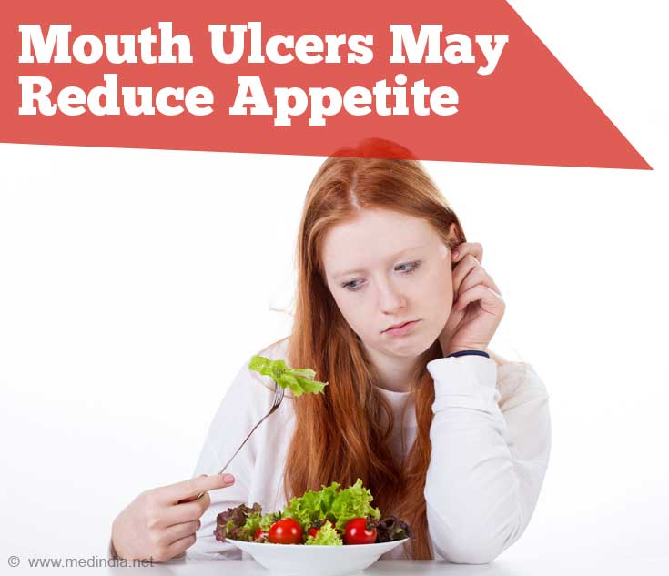 Loss of Appetite due to Mouth Ulcers Loss of Appetite due to Mouth Ulcers